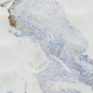 Nectin-4